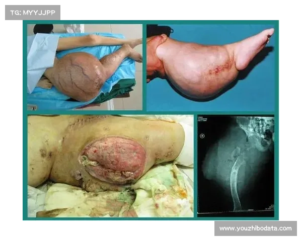 尤文图斯基金会发起募捐支持癌症科研项目 尤文图斯基金会发起募捐支持癌症科研项目